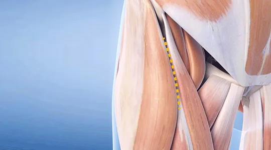 Approccio Anteriore Diretto APPROCCIO ANTERIORE DIRETTO 540x300 1