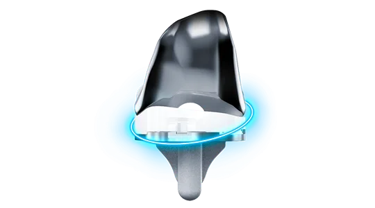 Ginocchio Emp94 540x300 1