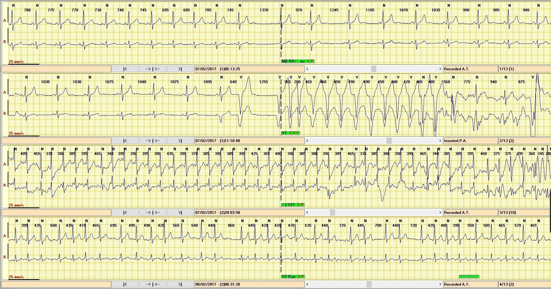 SPIDERFLASH Eventscope v2 1