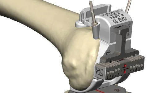 Prophecy®-Gap Balancing Flex Gap Drilling 1