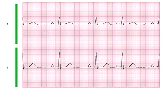 SPIDERFLASH Hookup3 Impedance check 1