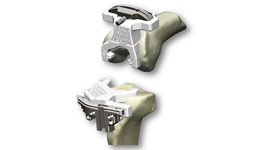 Prophecy® Prophecy Evolution image 540x300 1